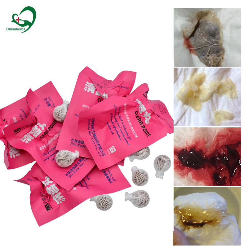 20 Buah Mutiara Yoni Titik Ber - Medical Wellness & Spa Werona ulasan dan harga